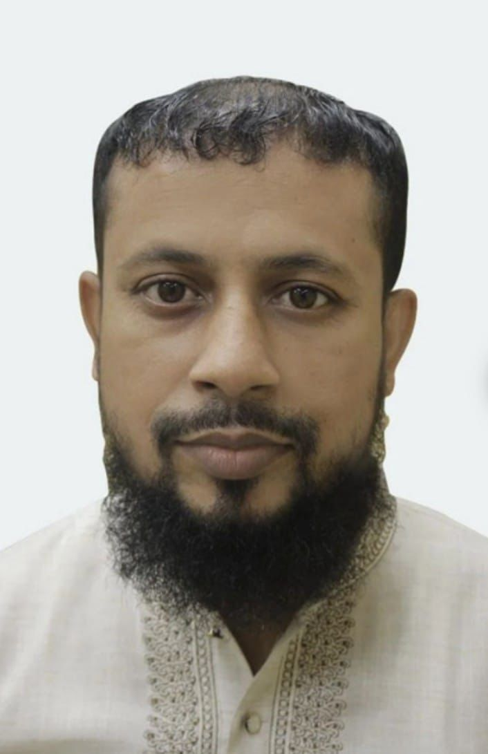 Before men's front hairline restoration